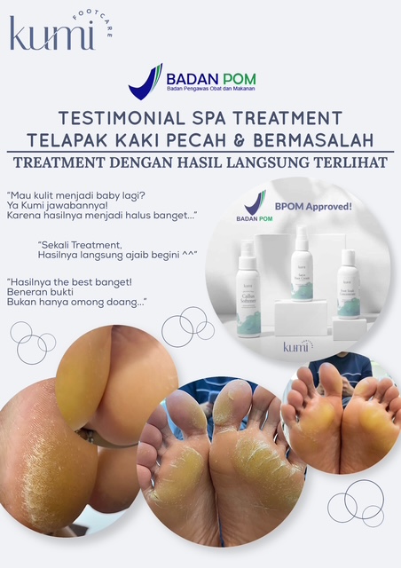 callus-pedicure-manicure-kutikula-kumi.jpg
