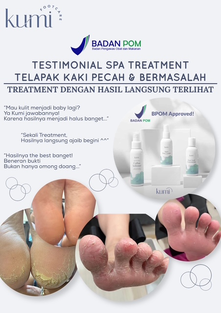 callus-pedicure-manicure-kutikula-kumi.jpg