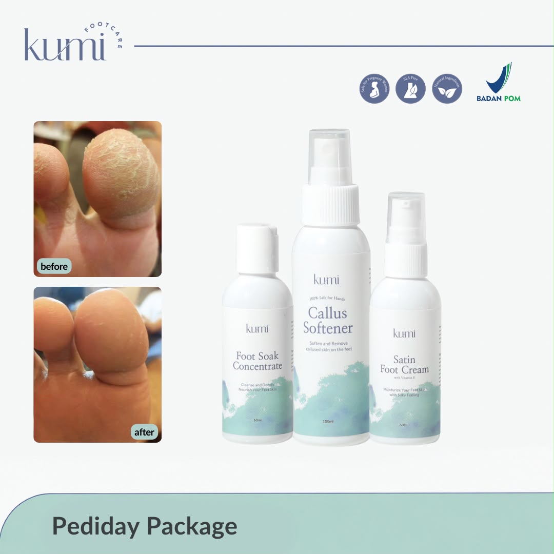 callus-pedicure-manicure-kutikula-kumi.jpg